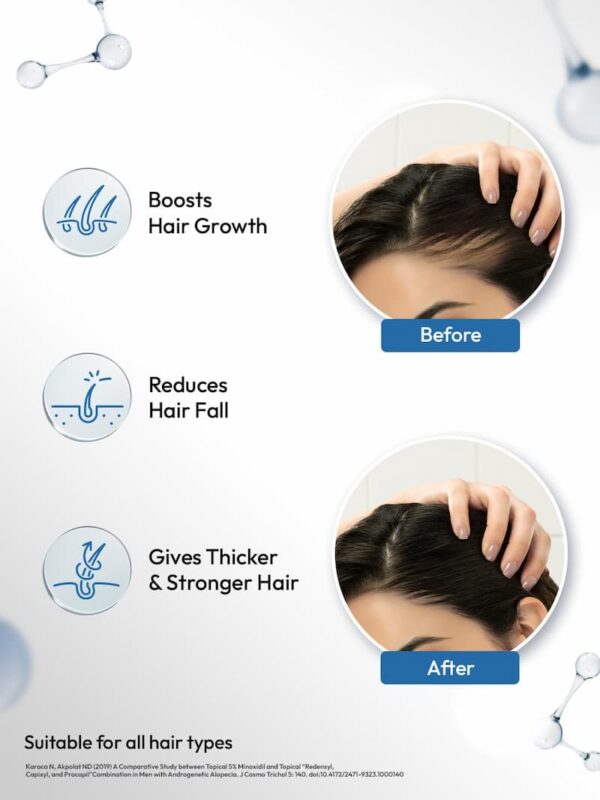 Scalpe Pro Hair Growth Serum chart to show how its work